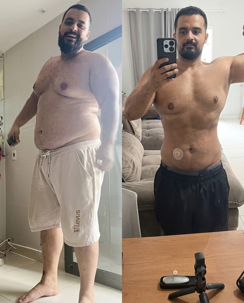 Resultado José L. - Perda de peso visível