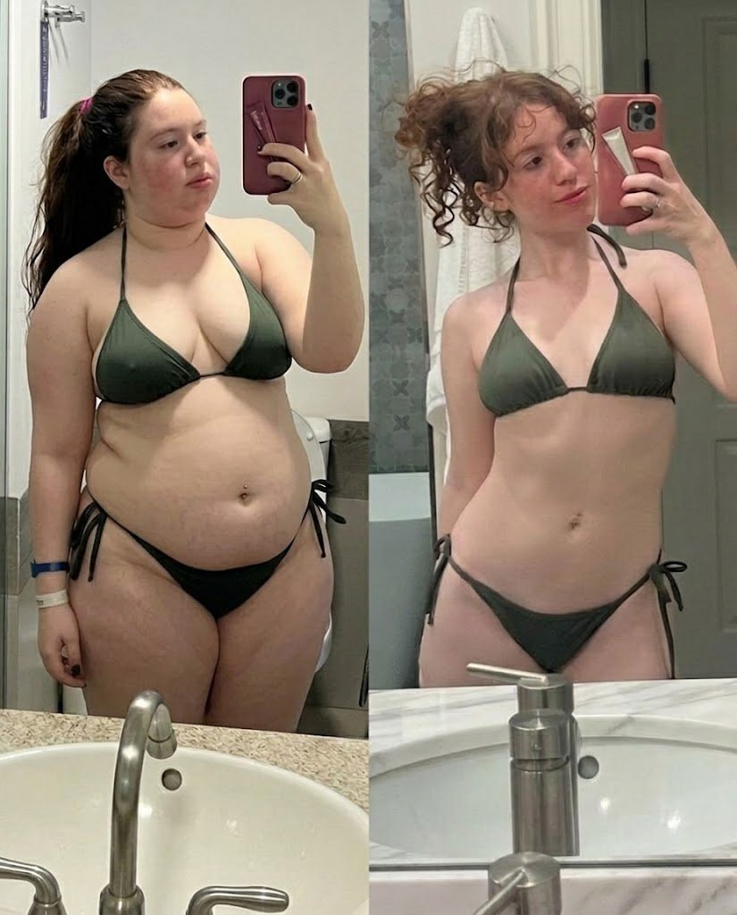 Resultado Sofia P. - Barriga mais lisa